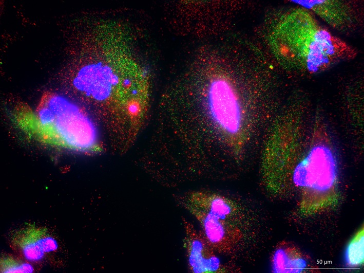 TDP-43 mislocalization TDP-43 mislocalization in iPSC-derived ,motor neurons